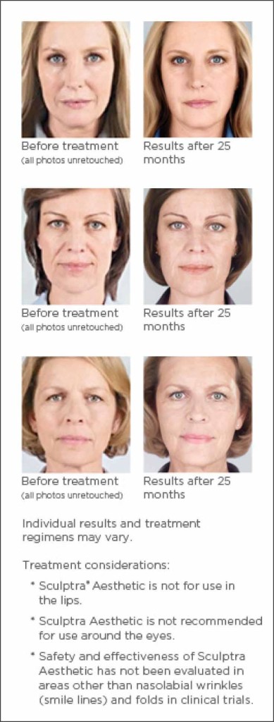 The smart Trick of Sculptra specialist in Beverly Ridge Estates That Nobody is Discussing thumbnail